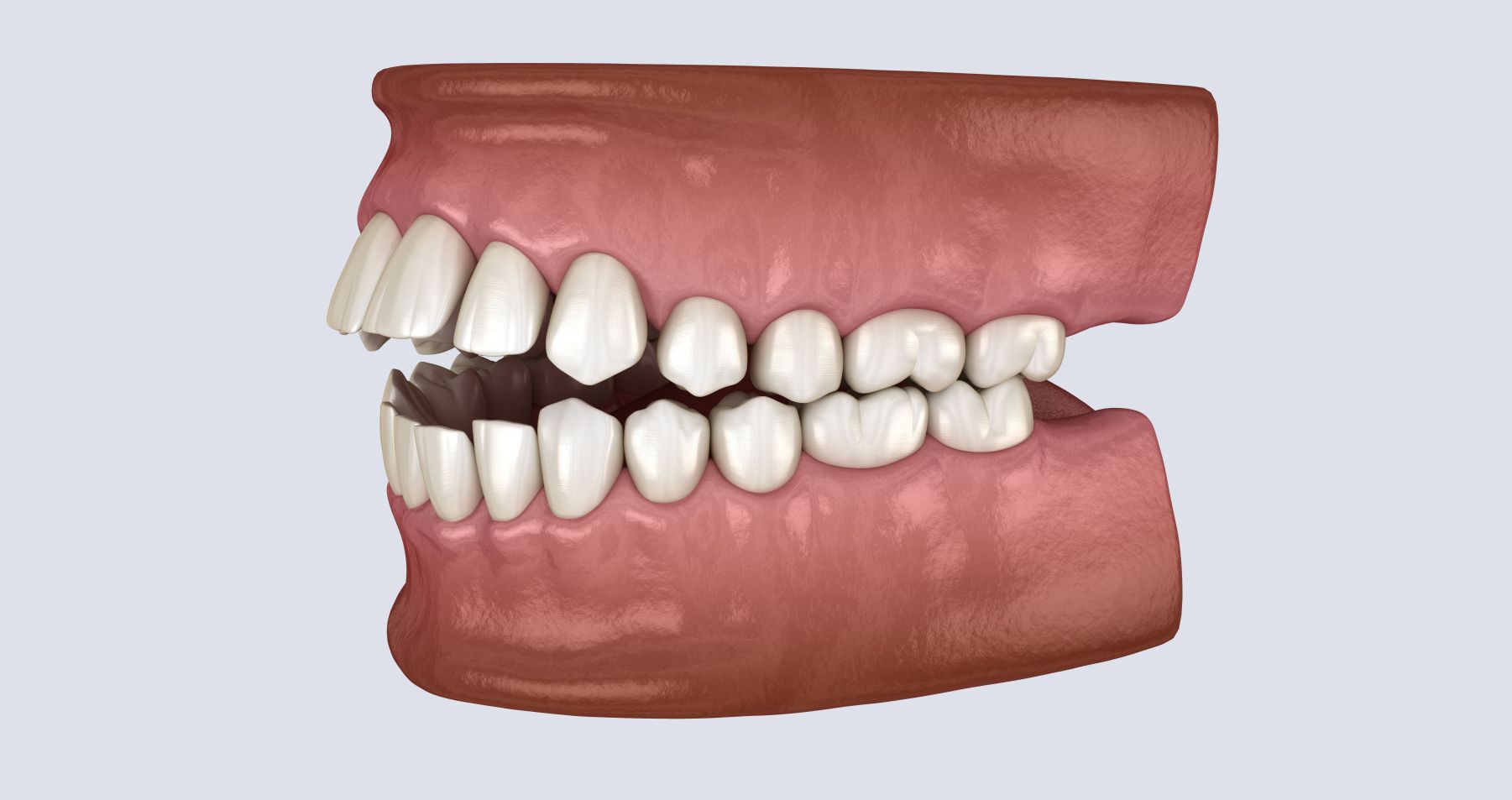 Dento Facial | Orthodontic Treatments in North Ogden, UT